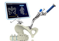 Mako Robotic Arm Assisted Hip Replacement