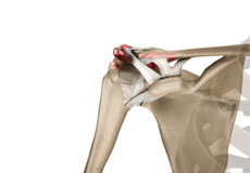 Acromioclavicular Joint Injury