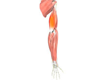 Triceps Repair